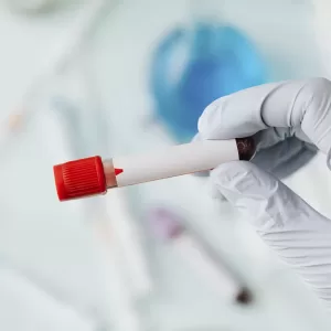 Hand of doctor holding a blood test tube during covid-19 outbreak